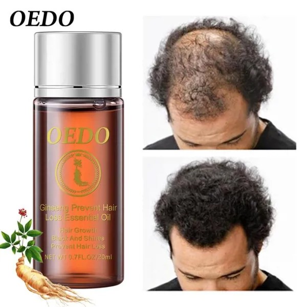OEDO Женьшень Укрепление волос Восстановление эфирного масла Поврежденные волосы Восстановление волос Уход за волосами