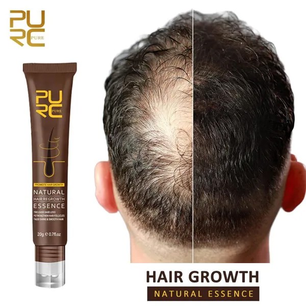 PURC Быстрое масло для роста волос Против выпадения волос Эссенция Уход за волосами Средства по уходу за мужчинами Женщины 20г