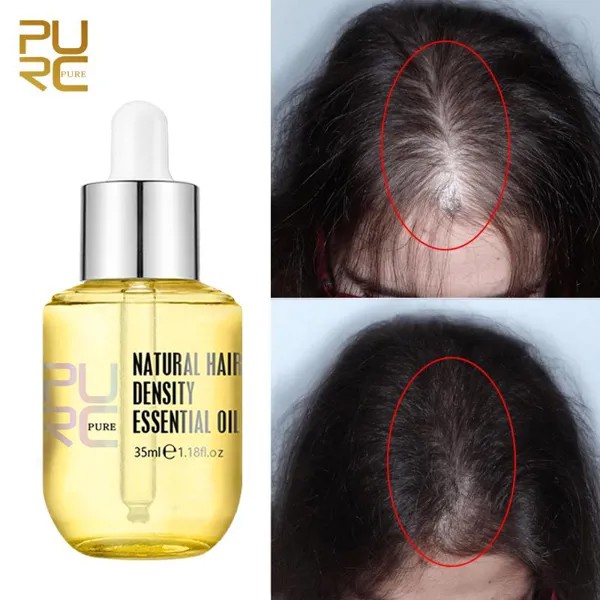 PURC Натуральный имбирь Против выпадения волос Эфирное масло Лечение роста волос Сыворотка средства по уходу за волосами для мужчин Женщин 35мл