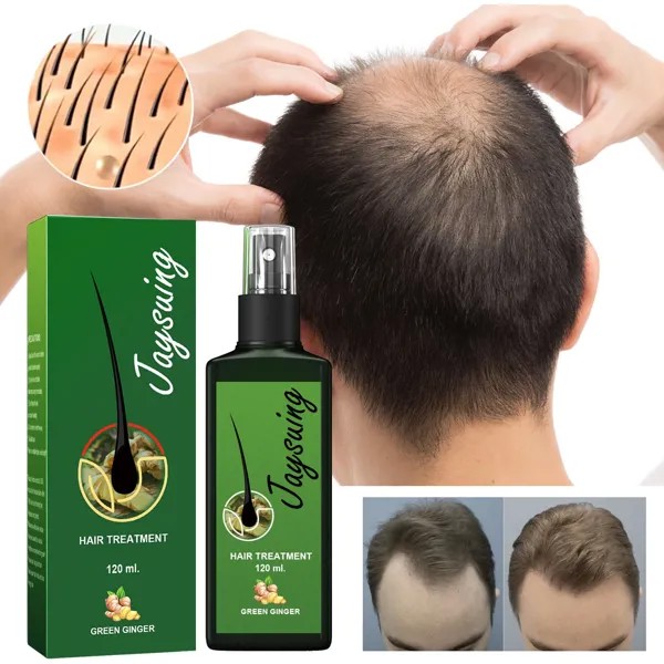 Лосьон для волос Оригинальное масло Для роста волос Уход за волосами Дольше Укрепление Бороды Лечение Сухое Вьющееся Поврежденное Тонкое Питание Уход