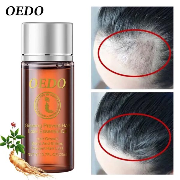 OEDO Женьшень Укрепление волос Эфирное масло Восстановление поврежденных волос Средства по уходу за волосами
